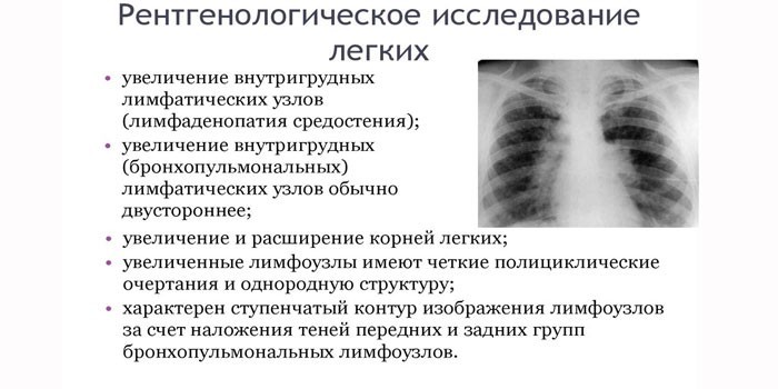 Что показывает рентгенологическое исследование