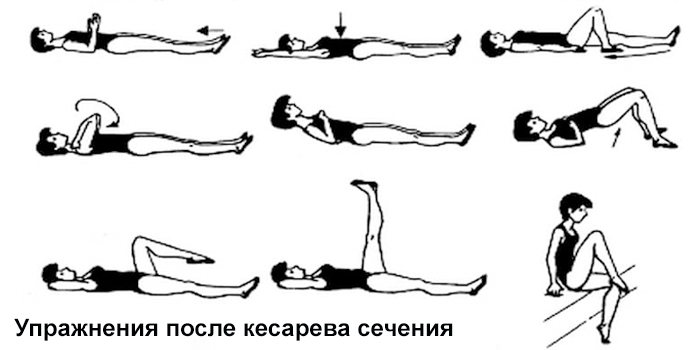 Упражнения после кесарева сечения