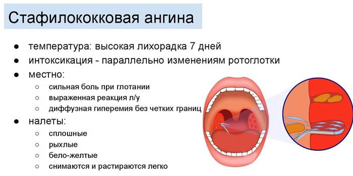 Симптомы и течение стафилококковой ангины