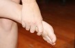 Изображение - Деформирующий артроз мелких суставов кистей рук лечение osteoartroz-stopy-lechenie-narodnymi-sredstvami_w110_h70