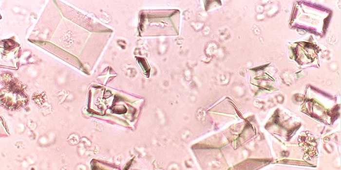 Оксалаты кальция под микроскопом