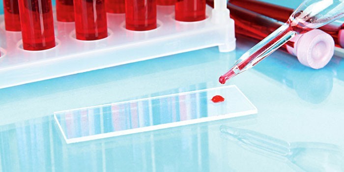 Анализ крови на лабораторном стекле
