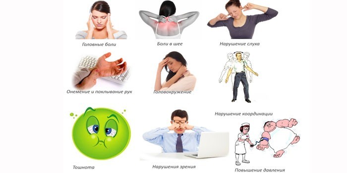 Симптомы остеохондроза шеи