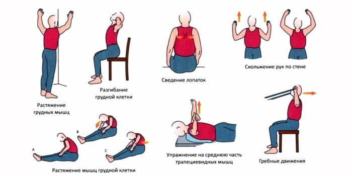 Упражнения при болях в спине
