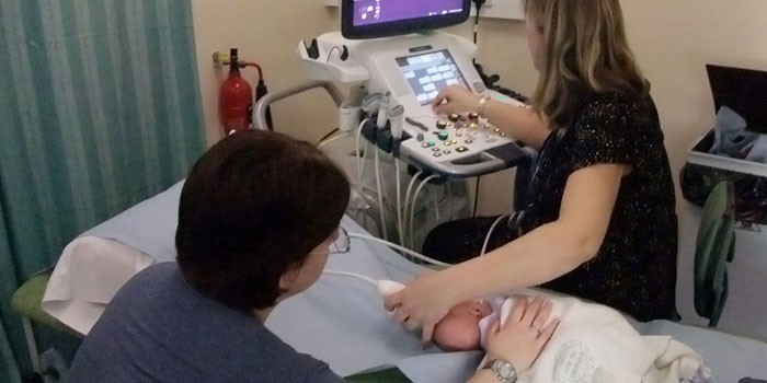 Новорожденный на УЗДГ-обследовании сосудов головного мозга