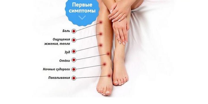 Симптомы жжения в ногах