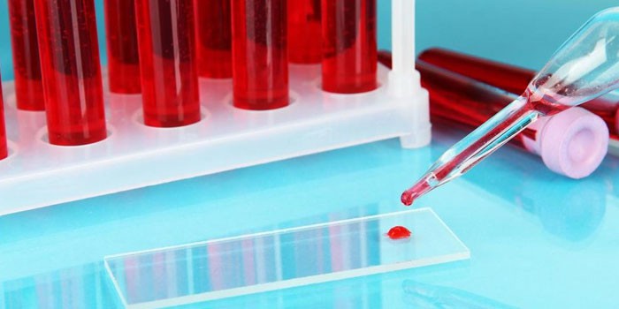 Анализы крови в пробирках и на лабораторном стекле