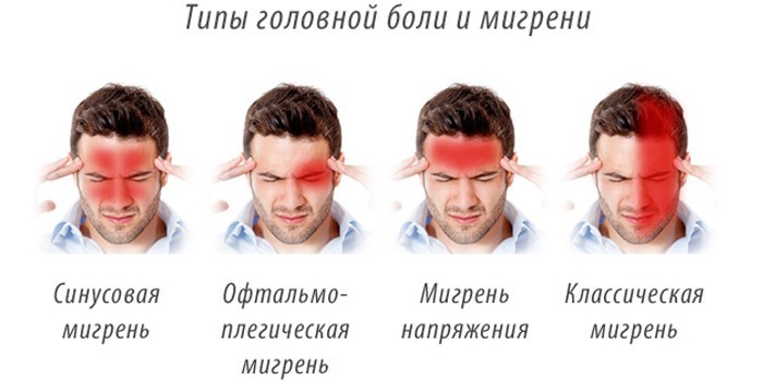 Типы головной боли