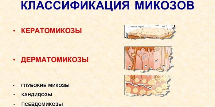 Классификация микозов