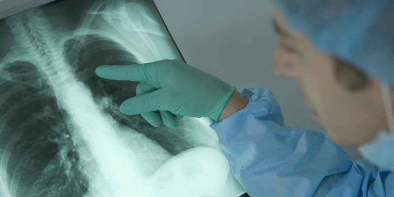 Медик изучает рентген легких