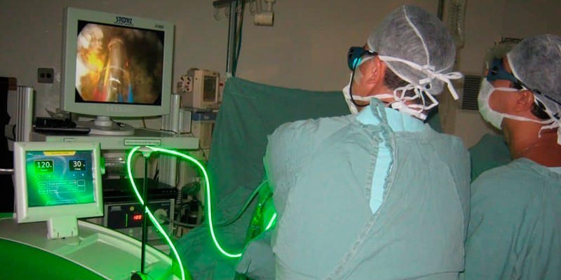 Медики проводят лазерную вапоризацию