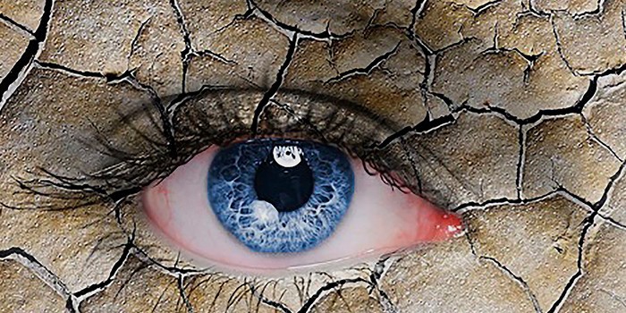Синдром сухости глаза