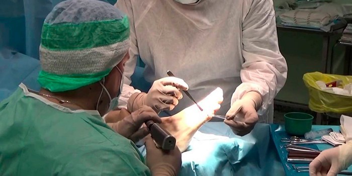 Хирурги на операции