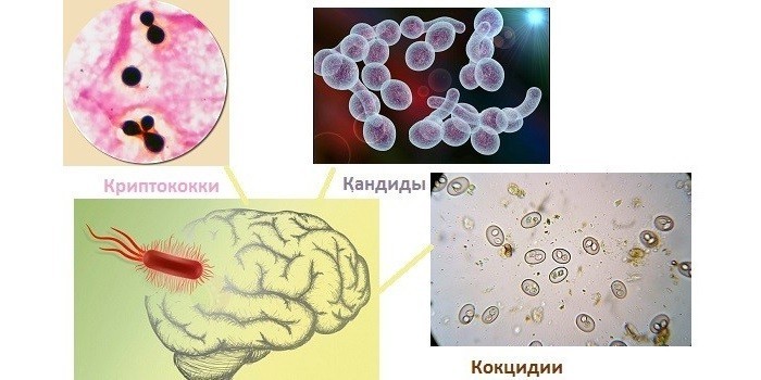 Причины менингита