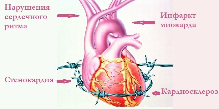 Причины нарушения сердечного ритма