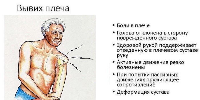 Симптомы вывиха плеча