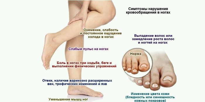 Симптомы нарушения кровообращения в ногах