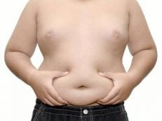 3 степени ожирения у детей и подростков — таблица по весу, диета и профилактика