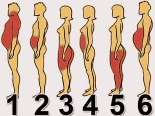 6 типов ожирения у мужчин и женщин - диагностика и методы лечения