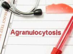 Агранулоцитоз у детей - симптомы и причины заболевания, диагностика