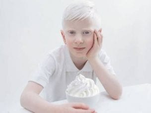 Альбинизм у человека - причины, симптомы и диагностика заболевания