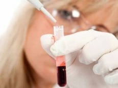 Анализ крови при скарлатине у детей — признаки заболевания, лабораторные исследования