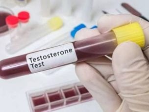 Анализ на тестостерон у мужчин - показания к назначению, правила подготовки и сдачи, расшифровка результатов
