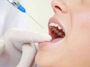 Анестезия при лечении зубов - методы обезболивания и их особенности
