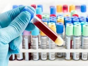 Биохимический анализ крови - что входит и расшифровка результатов