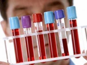 Что такое анализ крови на ПТИ - показания и способы проведения