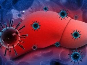 Диагностика вирусного гепатита С - первые признаки и проявления