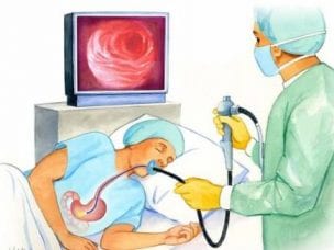 Диета перед гастроскопией желудка - как подготовиться к обследованию