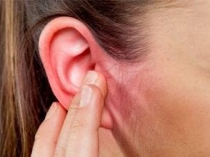 Диффузный отит: как лечить болезнь уха