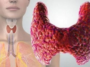 Гормон щитовидной железы Т4 - показания нормы для мужчин и женщин