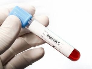 HBsAg анализ крови – что это означает