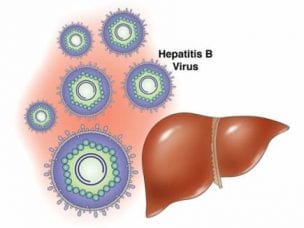 Хронический вирусный гепатит В - пути передачи, симптомы, диагностика и лечение