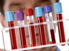 Иммуноферментный анализ крови — когда назначают и как подготовится, методика проведения