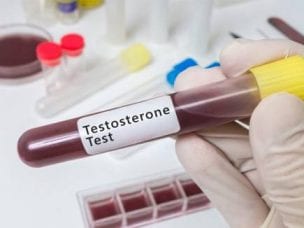 Индекс свободного тестостерона у женщин - показатели нормы, причины повышения или понижения