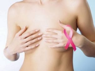 Инвазивный рак молочной железы