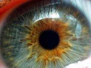 Лечение дистрофии сетчатки глаза народными средствами - травы, примочки и капли