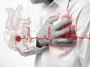 Лечение инфаркта миокарда - оказание первой помощи, медикаментозная терапия, народные средства и образ жизни