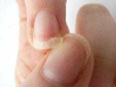 Ломаются ногти у мужчин и женщин — что делать в домашних условиях, правила ухода и салонные процедуры