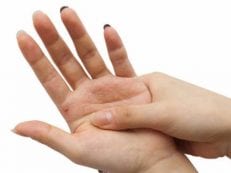 Немеют пальцы рук: причины и лечение