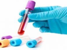 Норма билирубина у мужчин в расшифровке результатов анализов крови или мочи — причины повышения