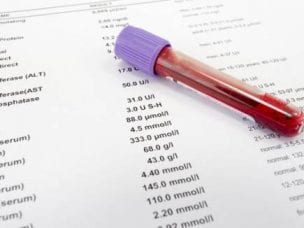 Норма ТТГ и Т4 - показания для проведения анализа на гормоны щитовидной железы и расшифровка результатов