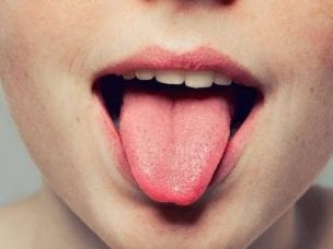 Причины и симптомы онемения языка