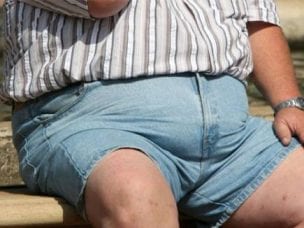 Ожирение по женскому типу у мужчин - причины, симптомы и лечение