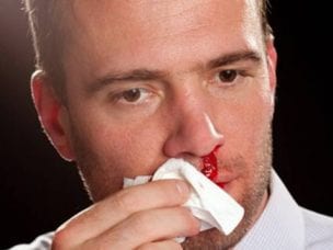 Причины кровотечения из носа у мужчин - травмы, заболевания и внешнее воздействие