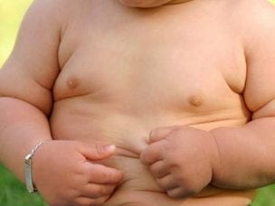 Причины ожирения у детей - экзогенные и эндогенные факторы