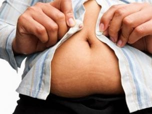Причины ожирения у мужчин - симптомы и типы патологии, методы лечения